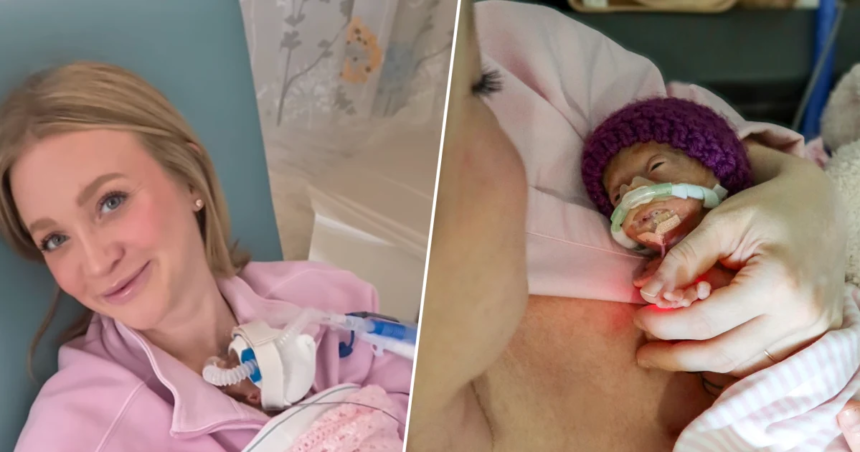 Video of Mom Holding 1-Pound Baby for First Time Goes Viral